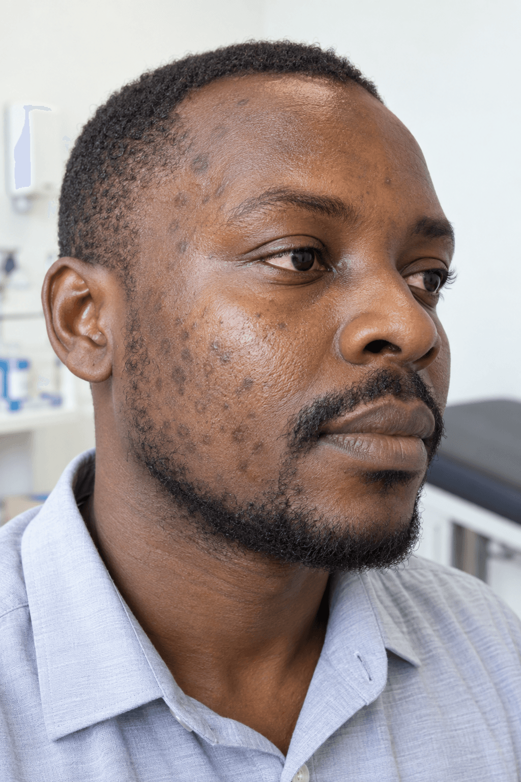 Illustrative close-up of post-inflammatory dark spots on melanin-rich skin